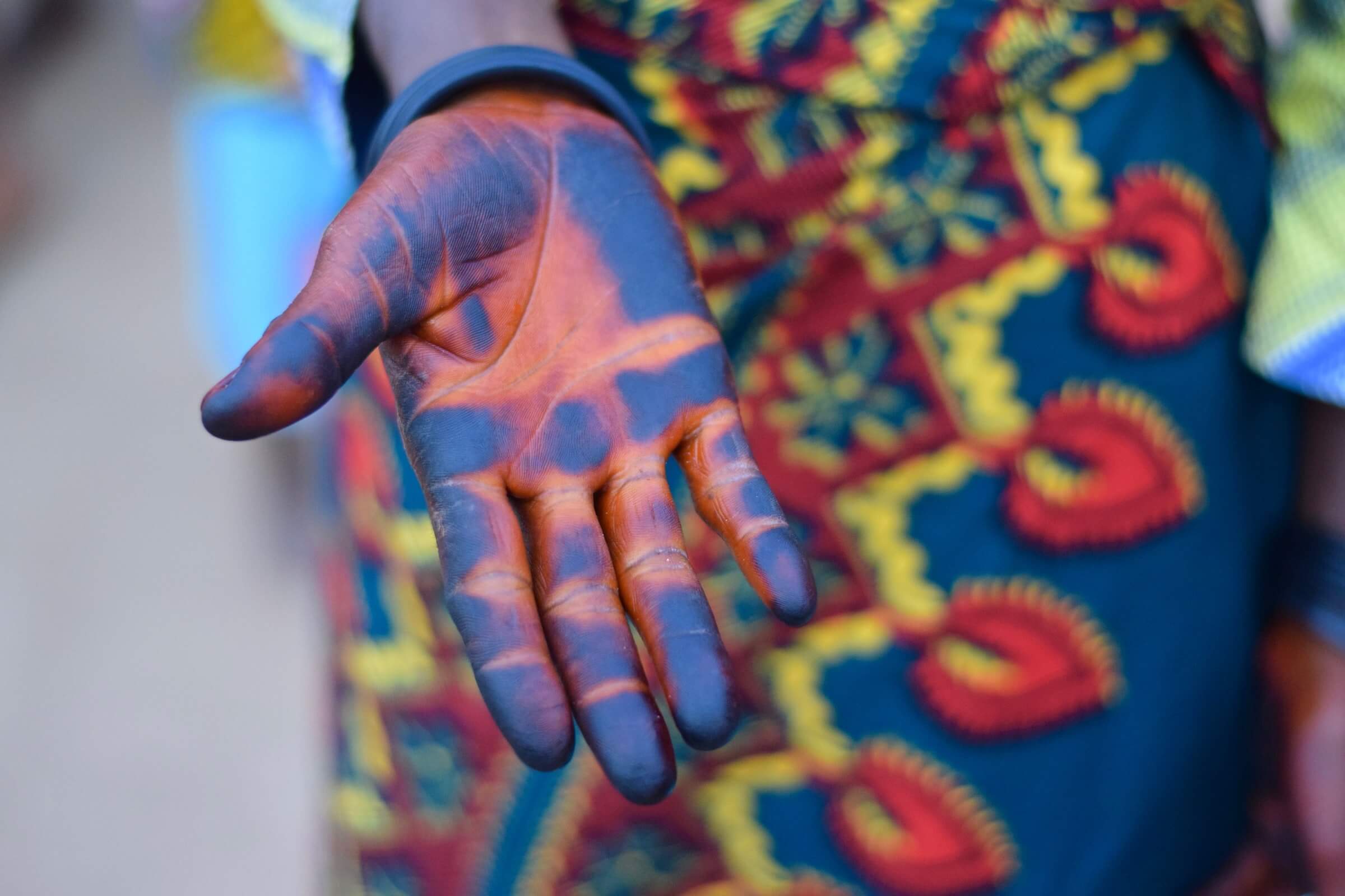 Palm of Outstretched Hand with Blue Dye